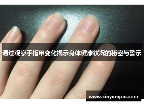 通过观察手指甲变化揭示身体健康状况的秘密与警示